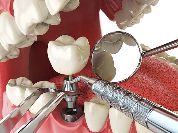 Best Pediatric Emergency Dentist in Fort Hunt, VA